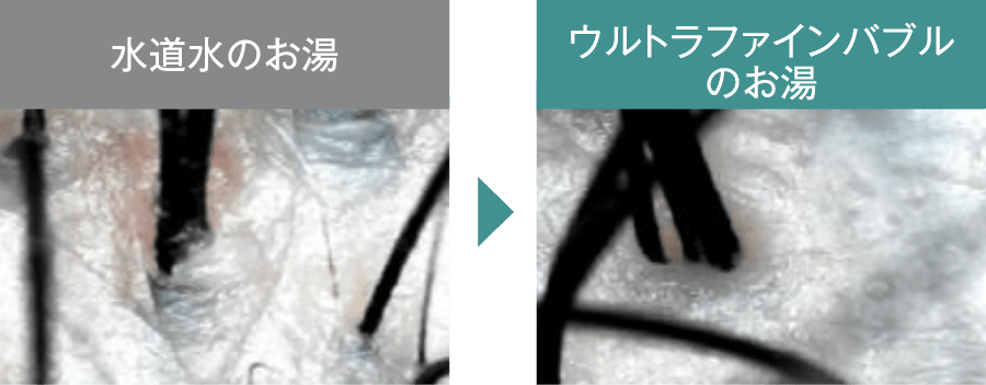 頭皮のにおいの発生を抑えます頭皮の皮脂汚れをすっきり落とし清潔を維持